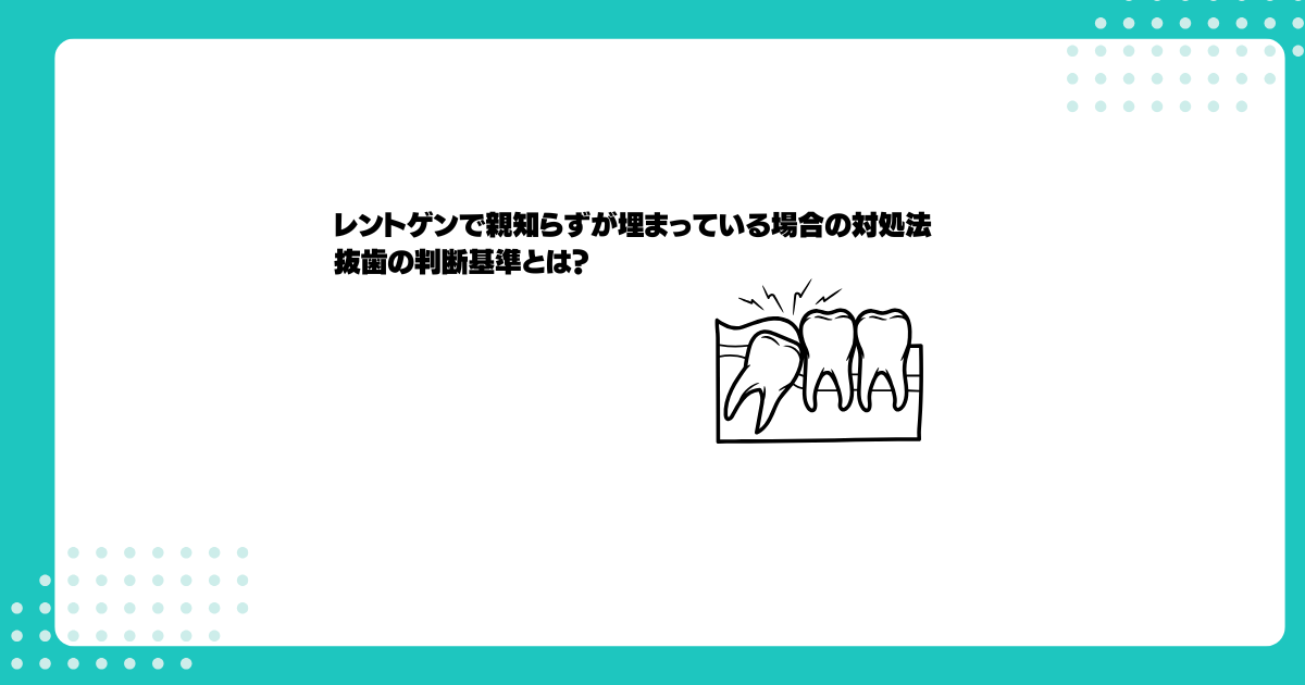 レントゲンで親知らずが埋まっている場合の対処法｜抜歯の判断基準とは？