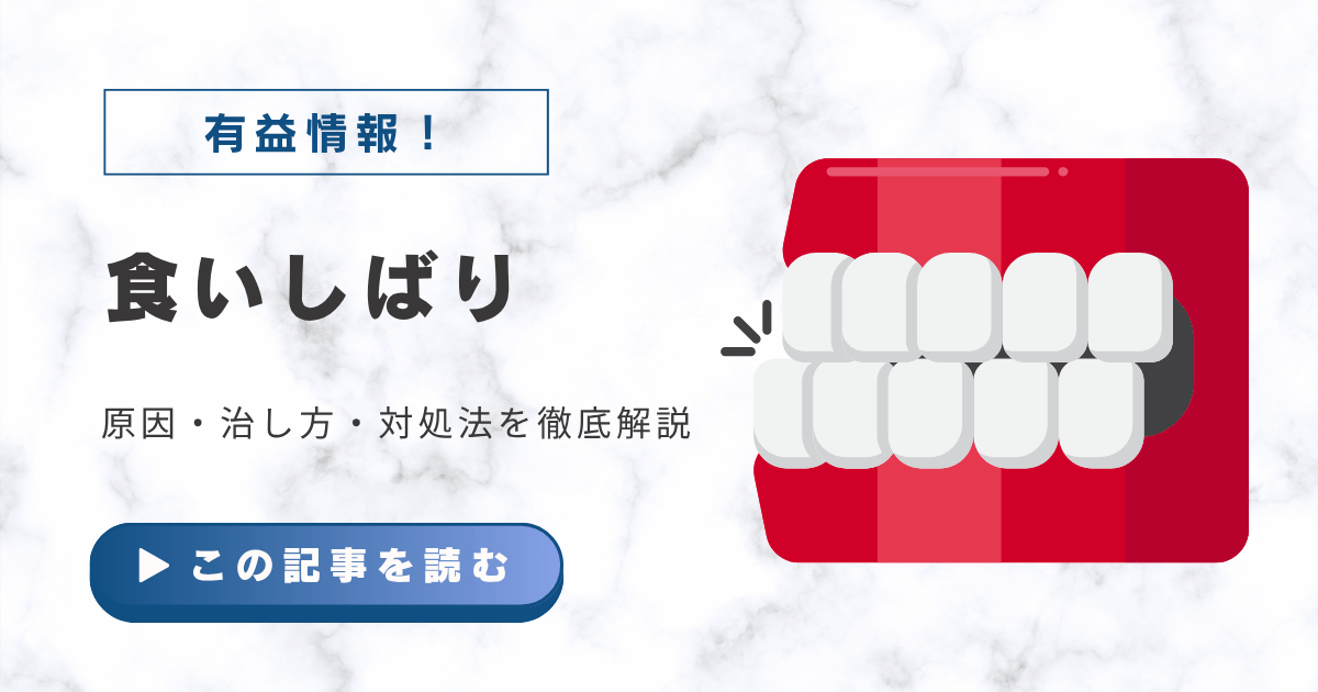 【食いしばりで歯が痛い】原因・治し方・対処法を徹底解説