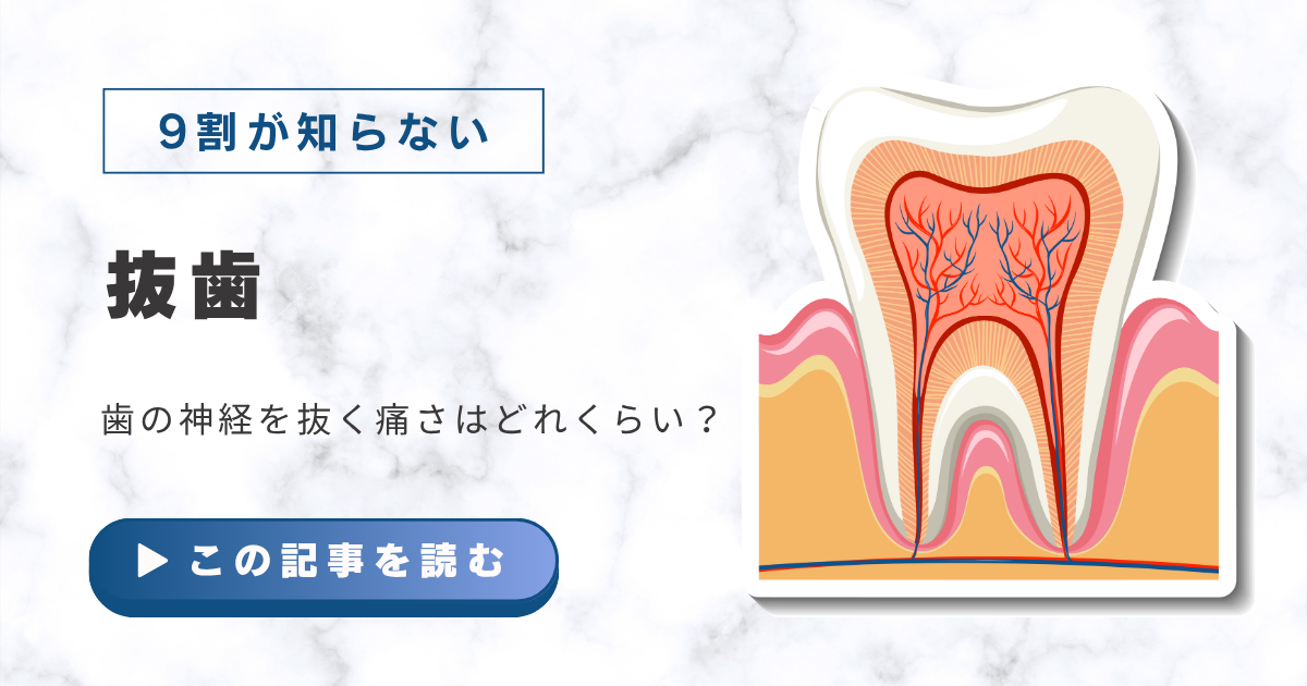 歯の神経を抜く痛さはどれくらい？痛みが続く期間・原因・対処法を徹底解説