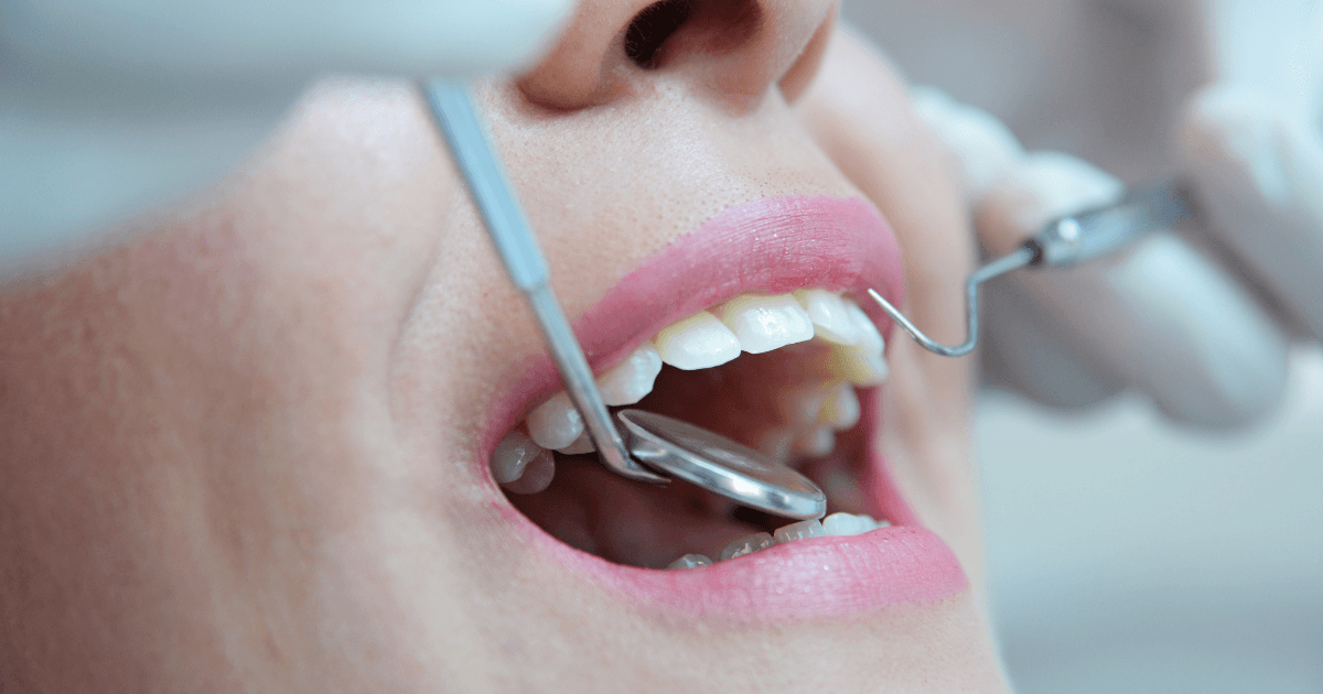 再発予防と長持ちのコツ