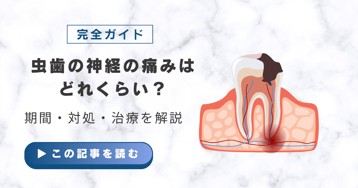 虫歯の神経の痛みはどれくらい？期間・対処・治療の完全ガイド