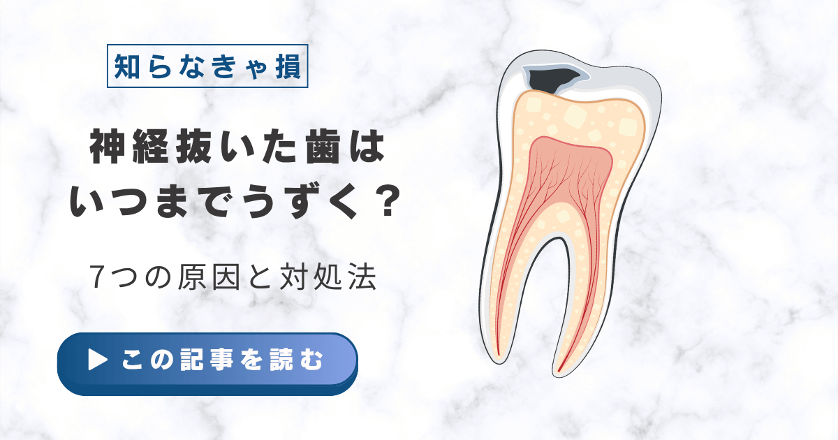 神経抜いた歯はいつまでうずく？7つの原因と対処法