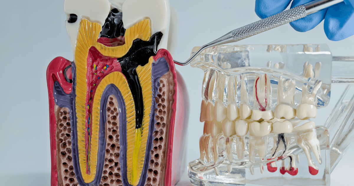 条件別の注意点
