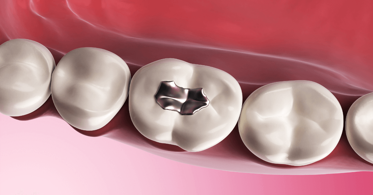 詰め物の素材別 特徴