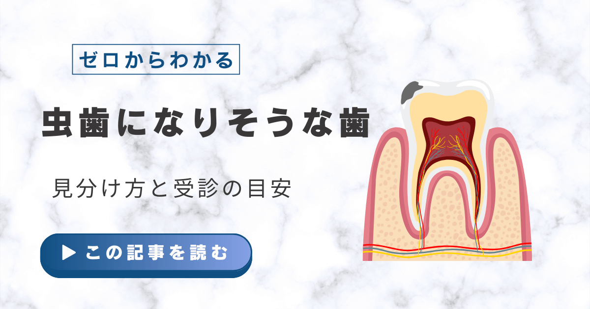 虫歯になりそうな歯