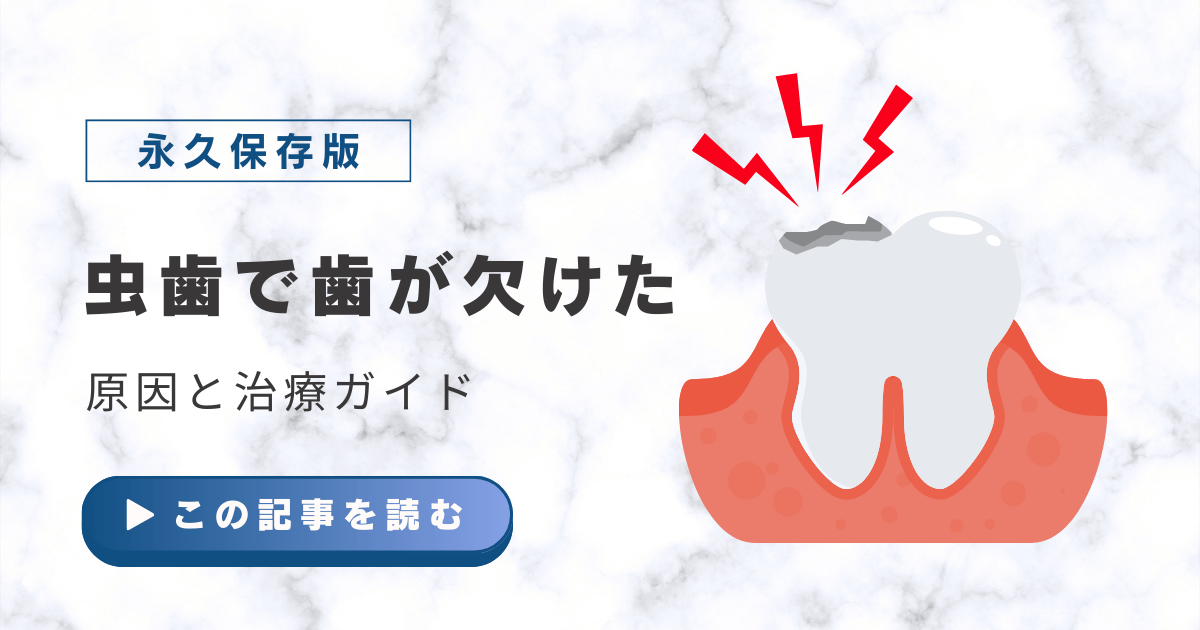 虫歯で歯が欠けたときの原因と治療ガイド【永久保存版】 - 虎ノ門の 