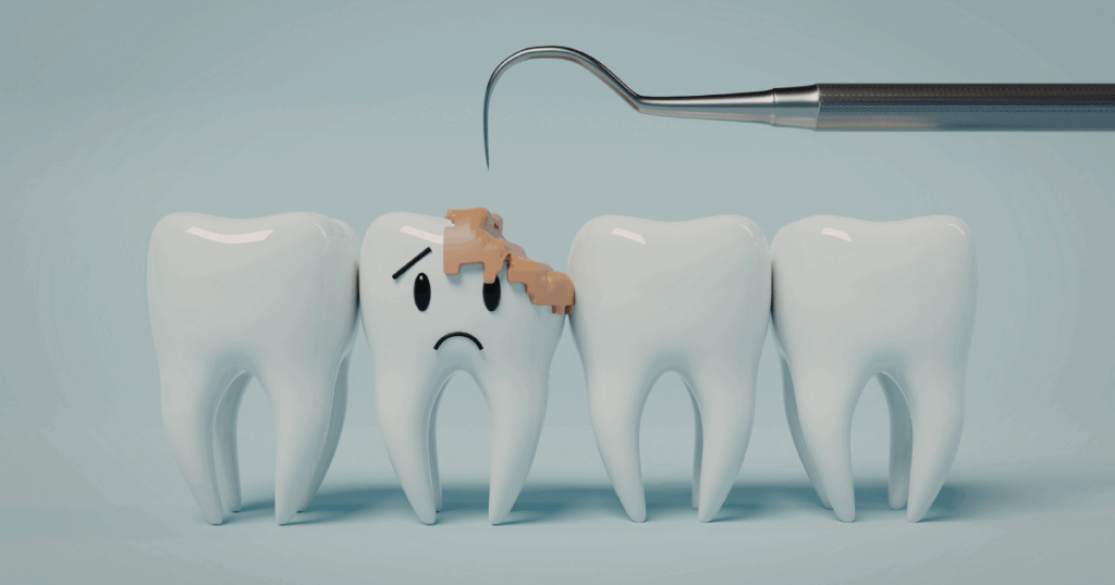 虫歯　歯　欠ける　メカニズム