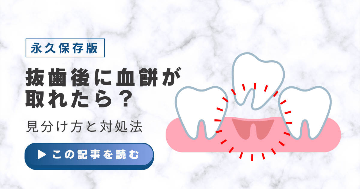 抜歯後　血餅　取れた