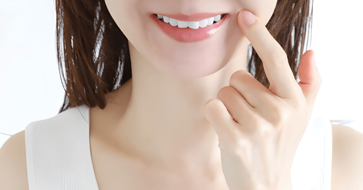 ラミネートベニア　メリット