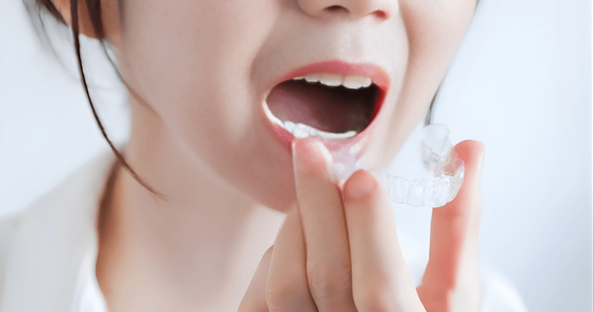 ラミネートベニア　向かない人