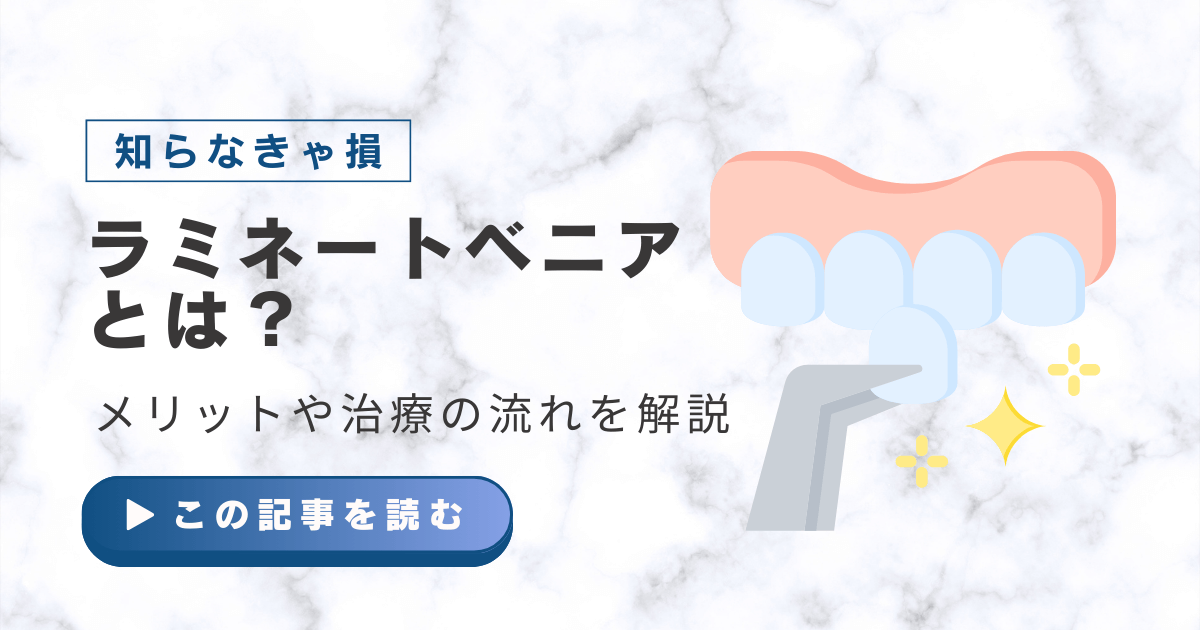 ラミネートベニア