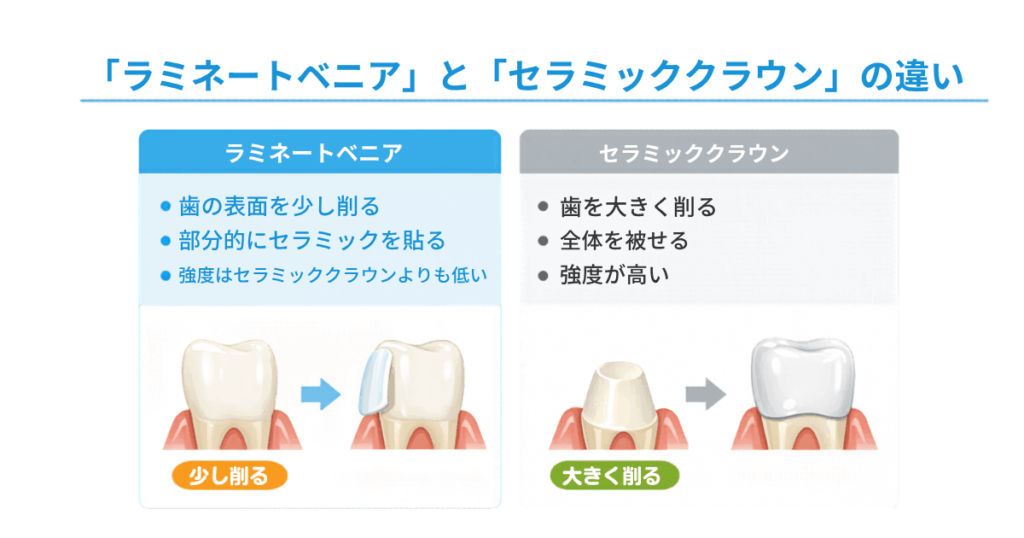 ラミネートべニアとセラミッククラウンの違いを説明する図