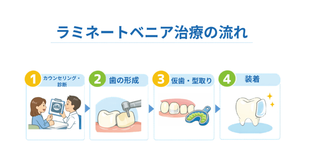 ラミネートべニア治療のフロー図