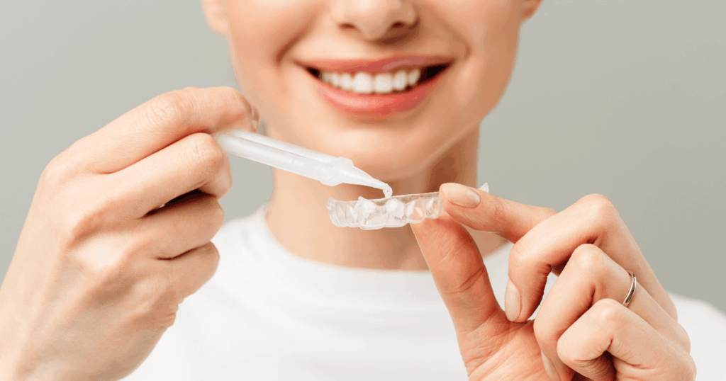 ラミネートべニア以外の治療